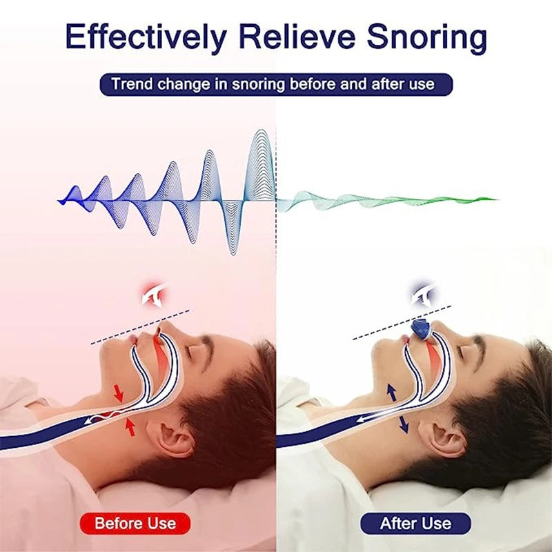 Electric Anti Snoring Devices